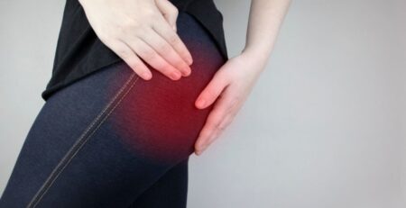 Woman Suffering from Sciatic Nerve Pain