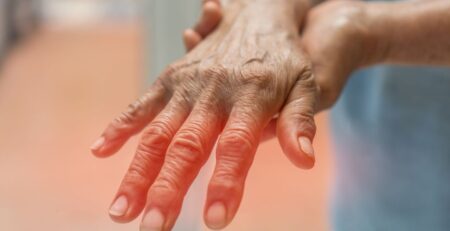 Can a Chiropractor Help Neuropathy?